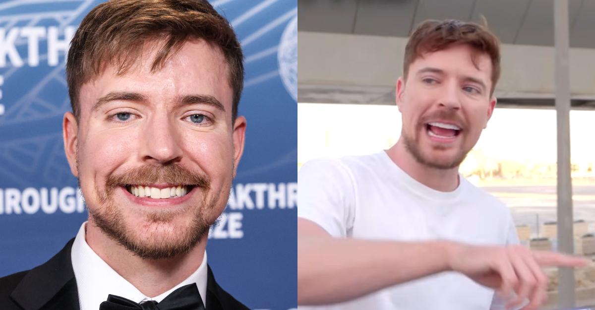Did Mr. Beast Get Veneers? It's Complicated
