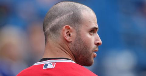 what happened to tommy la stella cover