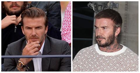 Did David Beckham Get Plastic Surgery?