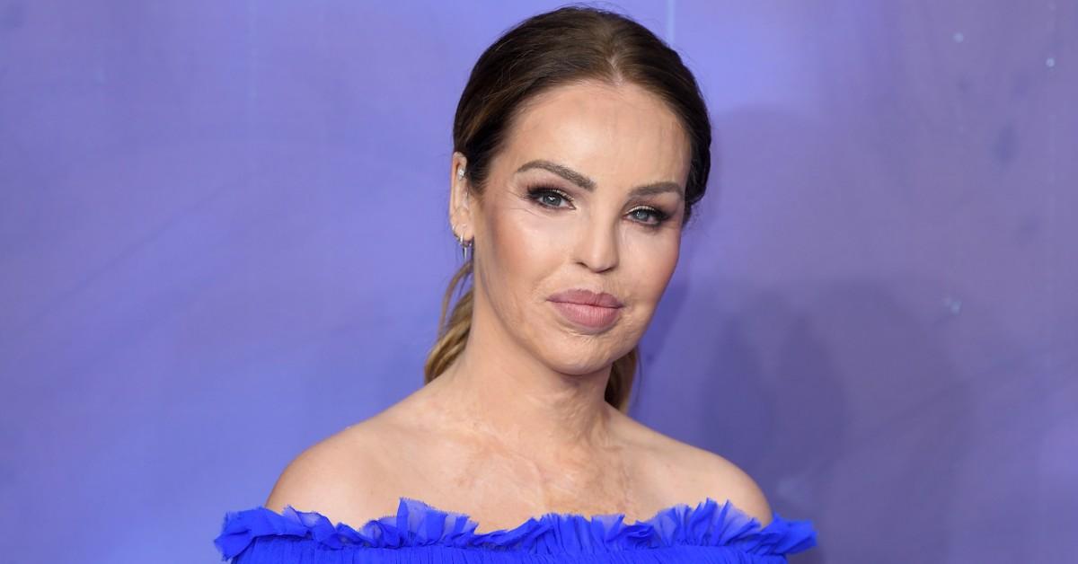 We're Shocked to Learn What Happened to Katie Piper 11