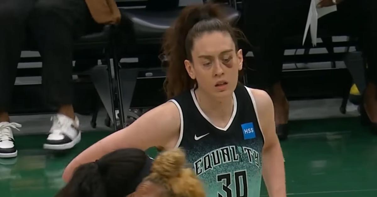 Breanna Stewart sports a black eye during the Liberty-Storm game on May 30, 2023.