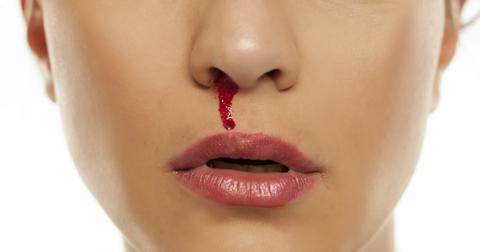 bloodynose-1532114789646-1532114791421.jpg