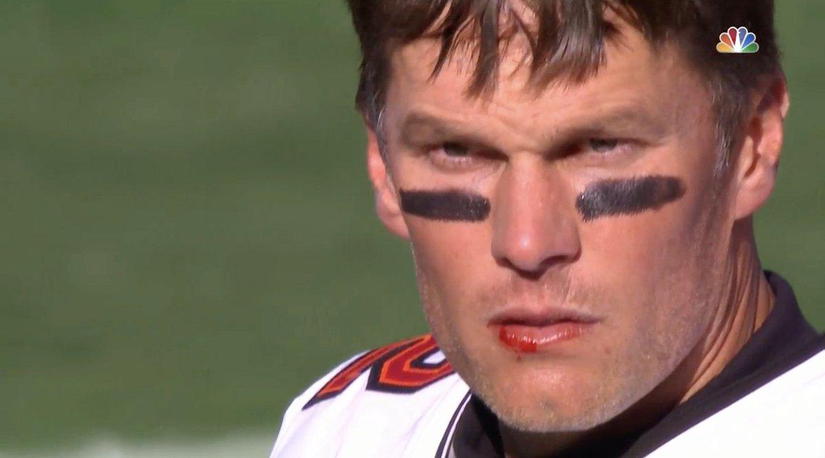 Here Are the Best Memes Roasting Tom Brady and His Bloody Lip