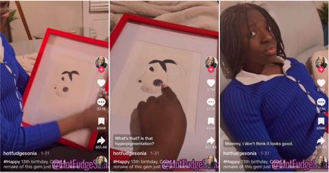 What Is the Hyperpigmentation Meme on Tiktok? It Started in 2019