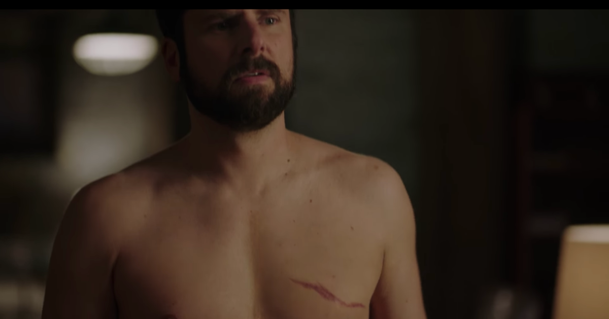 Did James Roday Have a Heart Operation? Surgery Rumor Details