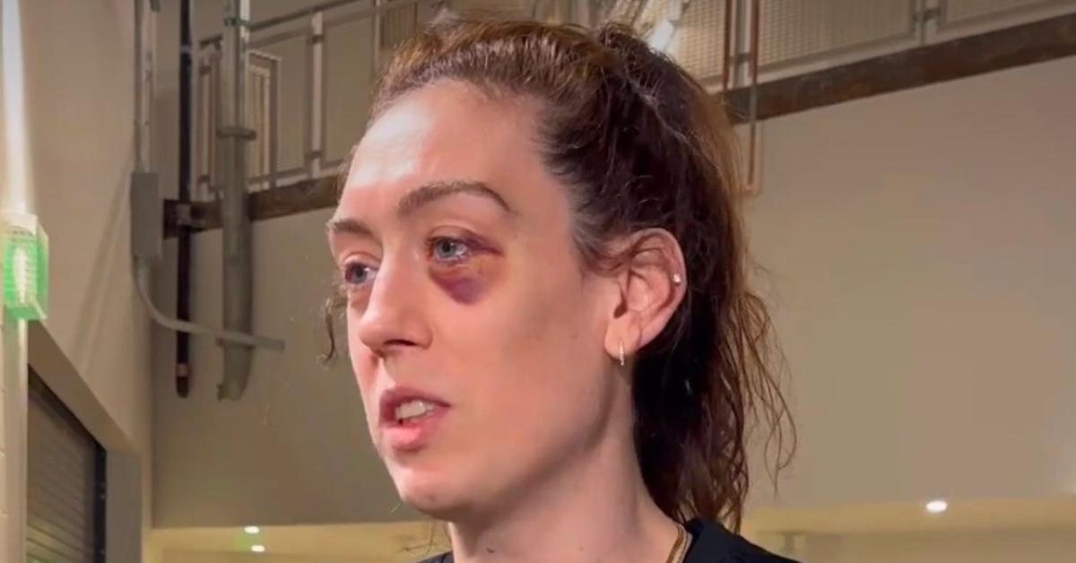 What Happened to Breanna Stewart's Eye? Injury, Explained