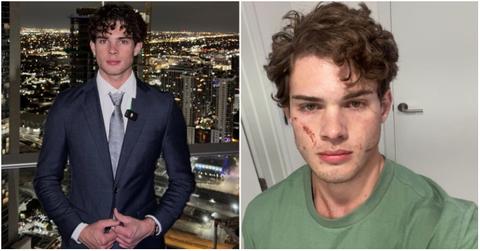 Clavicular’s Alleged Overdose Moment Caught on Livestream