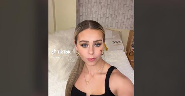 Scar Girl TikTok