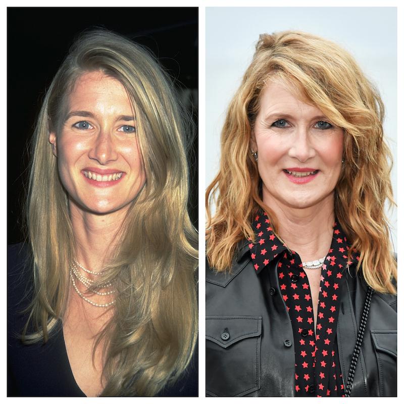 laura dern plastic surgery