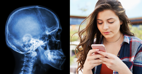 skull changes featured