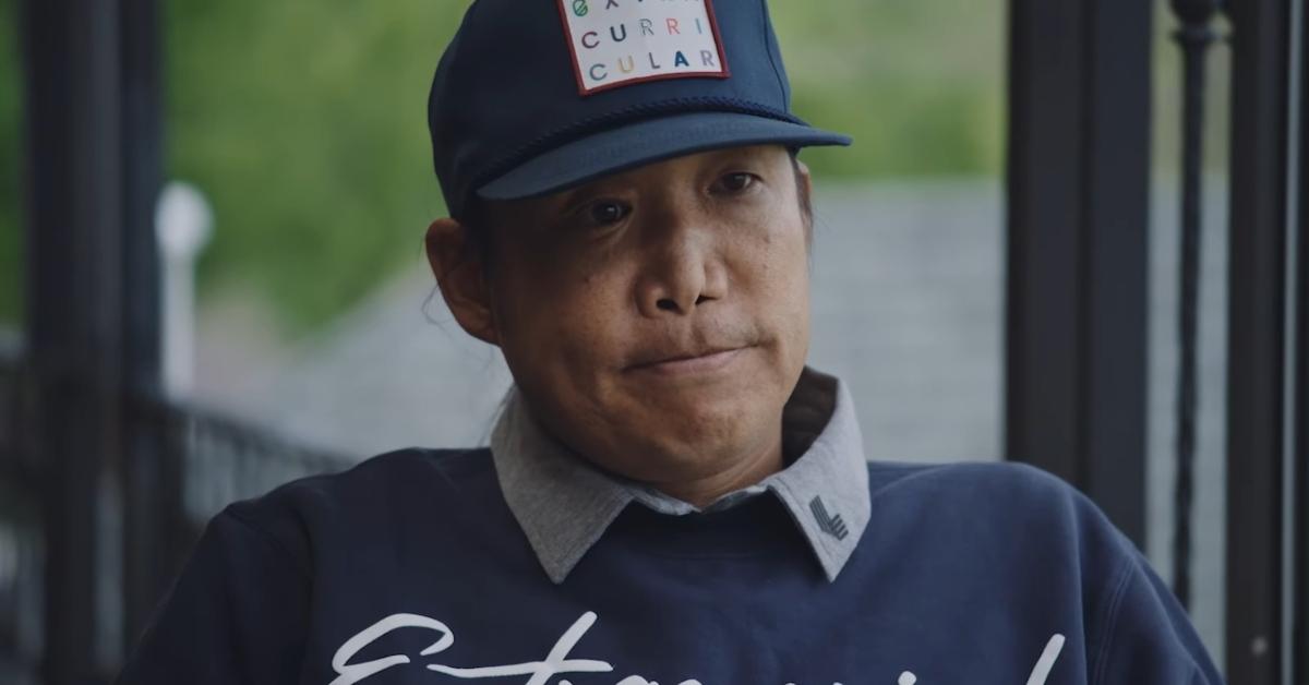 What Happened to Anthony Kim's Face?