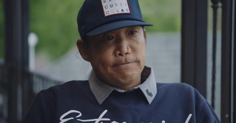 What Happened to Anthony Kim's Face?