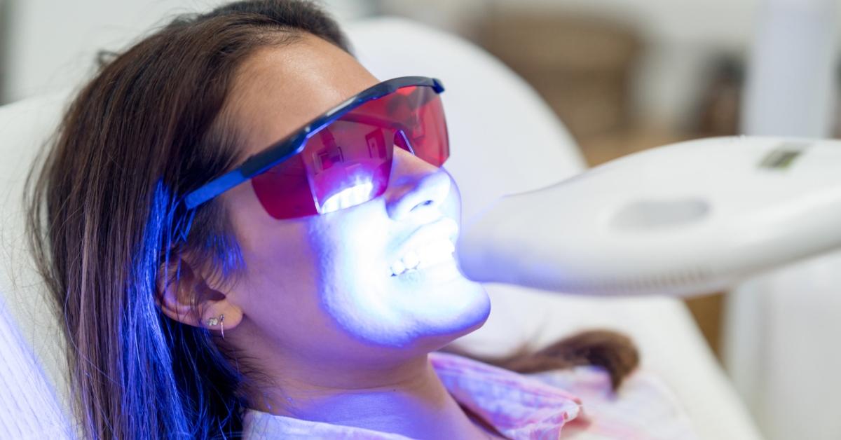 A Teeth Whitening Trend Went Viral on TikTok — but, Is It