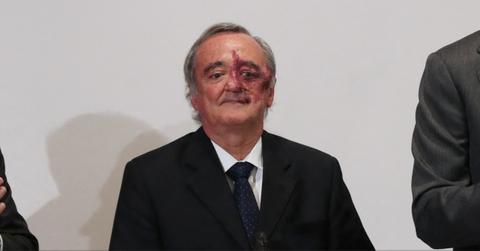 Why Are People Asking What Happened to Mariano Barbacid's Face?