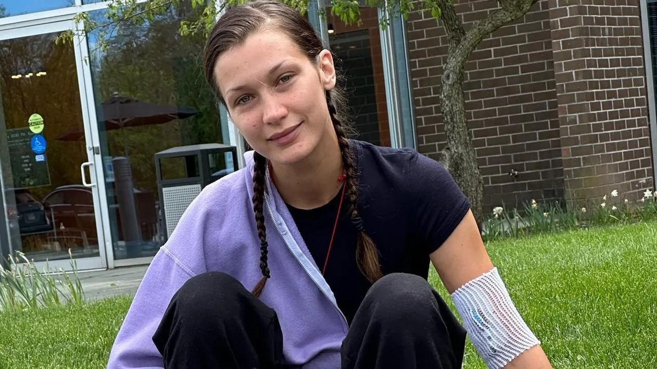 Bella Hadid sitting in the grass with a bandage on her arm