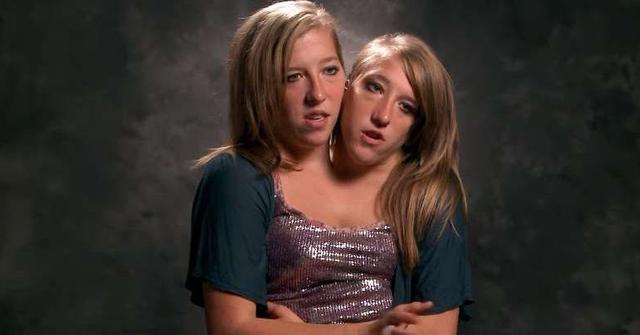 Where Are Conjoined Twins Abby And Brittany Hensel Today 