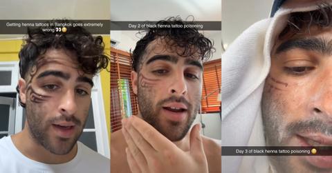 Influencer Warns Against Black Henna Tattoos — "I'm Going to Have a Full Blister Scar"