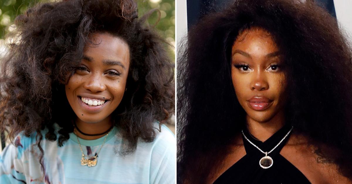 Sza Before Surgery See How Much She's Changed Over the Years