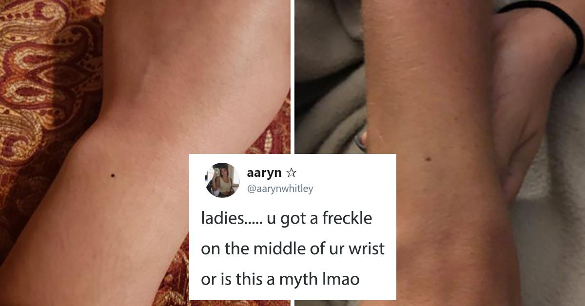 Women All Have the Same Freckle on Their Wrist and It's Freaking People Out