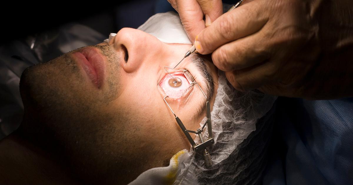 laser eye surgery