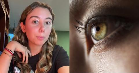 Woman Tries TikTok Beauty Hack, Needs Eye Surgery After