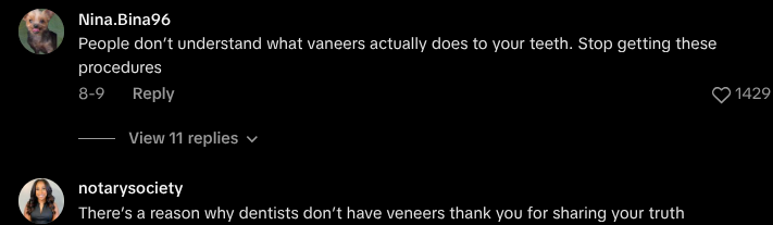 dont get veneers