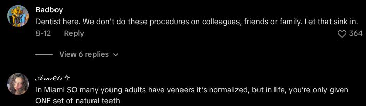 dont get veneers