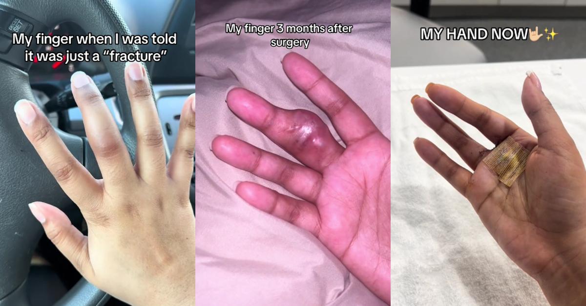 Doctors Miss Tumor Amputate Finger