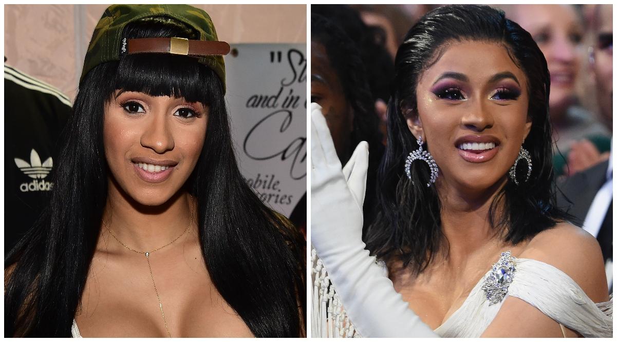 cardi b teeth before after