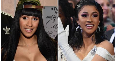 Cardi B S Teeth Transformation A Complete Breakdown