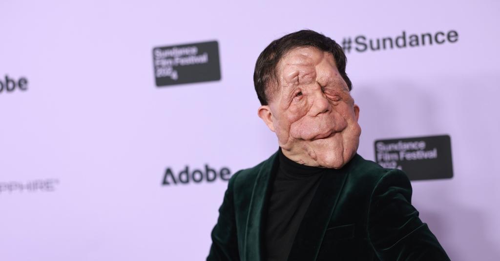 Is Adam Pearson Married? And What Is He up to Now?