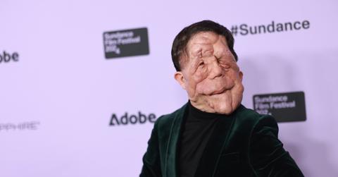 Adam Pearson at Sundance Film Festival