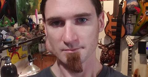 Kevin Olaeta dr pimple popper