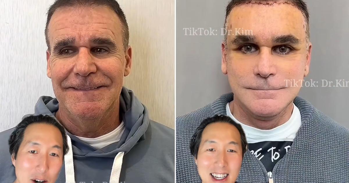 Dr. Kim plastic surgery reaction
