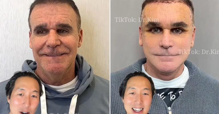 Inside the Dr. Kim Plastic Surgery Controversy on TikTok