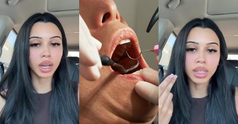 Woman Who Regrets Getting Veneers Cautions Others Against It