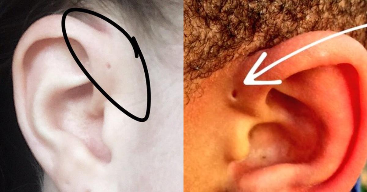 People Are Learning the Tiny Holes Above Their Ears Can Be Explained by