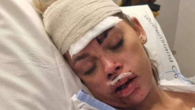 Tayla Gibbs after her accident