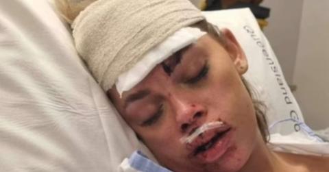 Tayla Gibbs after her accident