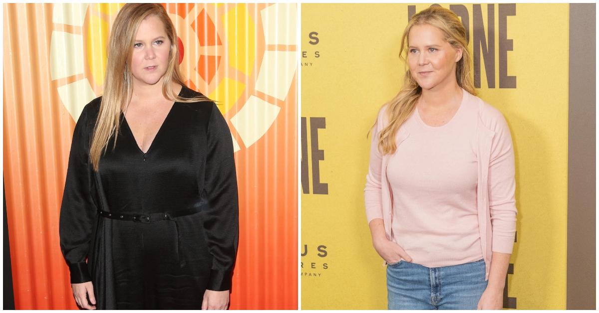 amy schumer before after