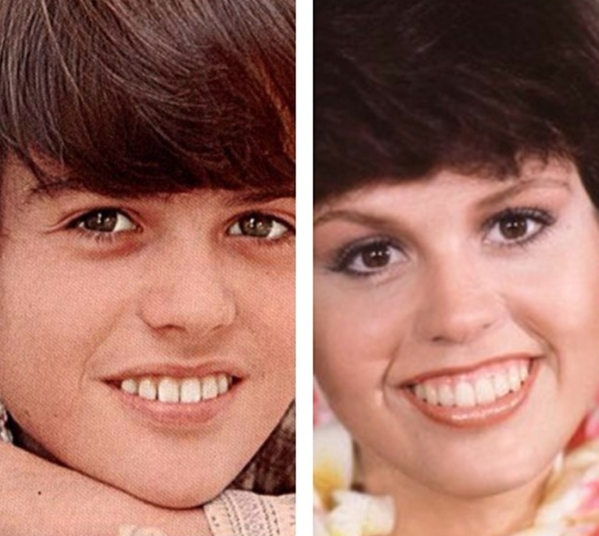 marie osmond before and after