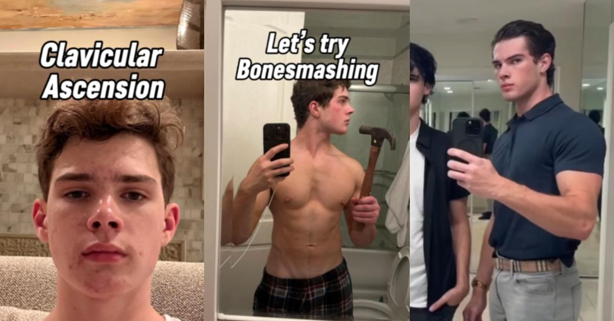 In a video, Clavicular shared photos of what he looked like before and during his looksmaxxing journey.
