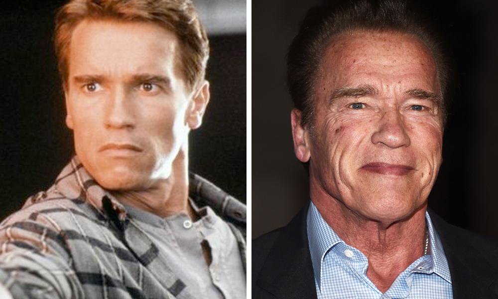 arnold schwarzenegger sun damage