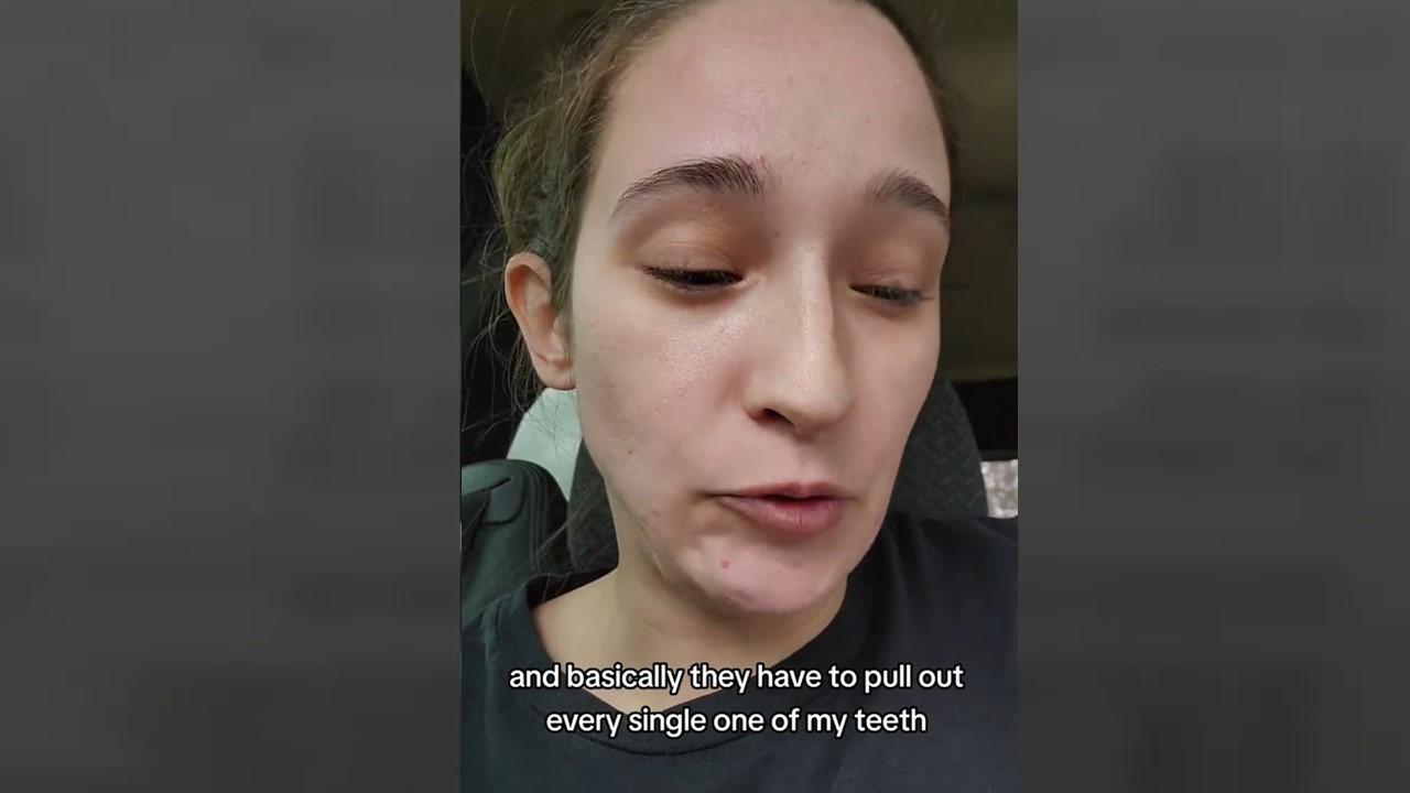 A woman describing how she had to have all of her teeth pulled due to poor dental hygiene