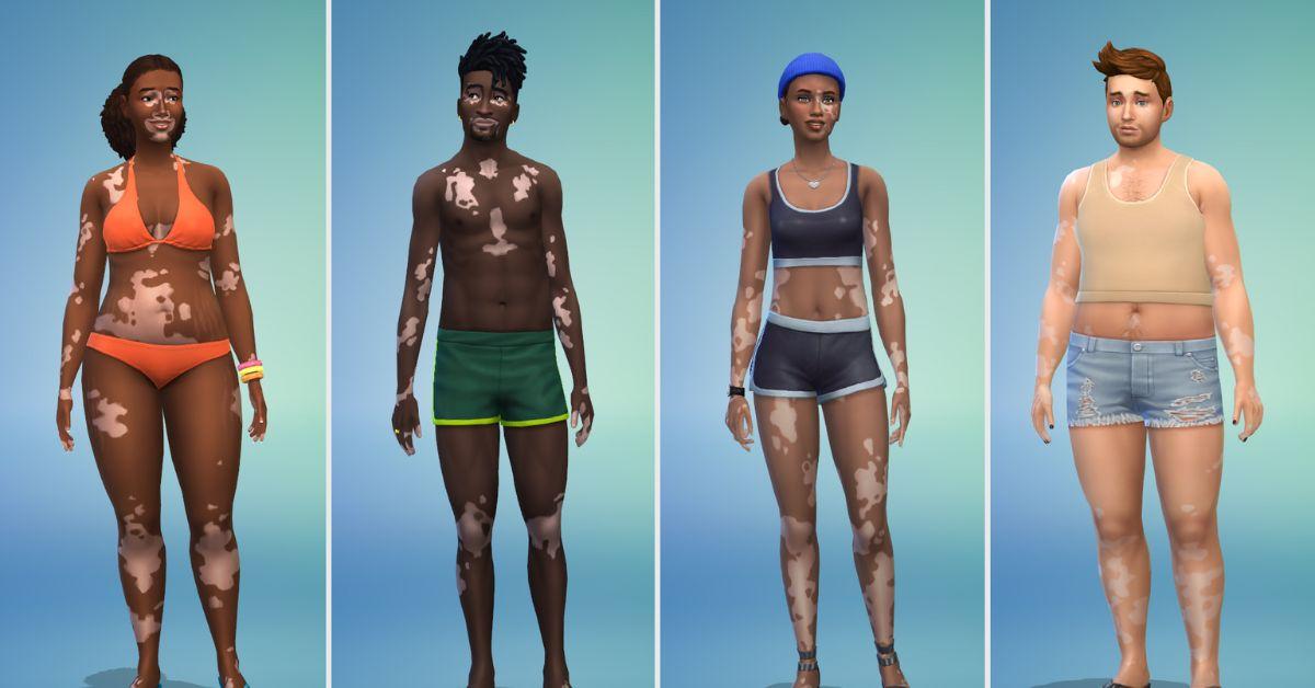 vitiligo update on multiple sims