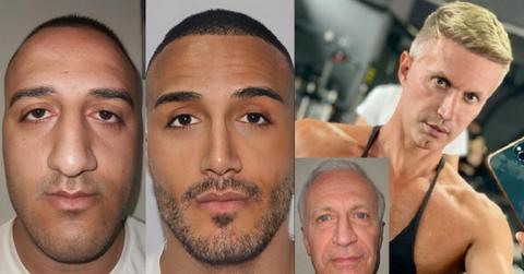 Turkish Plastic Surgery Account Has Internet Shocked by Results