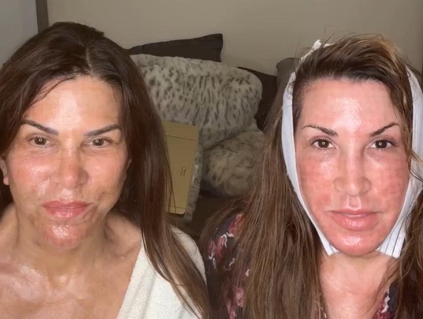 Lynne Curtin and Jac Laurita, from the 'Real Housewives' franchise, show off their post-plastic surgery looks