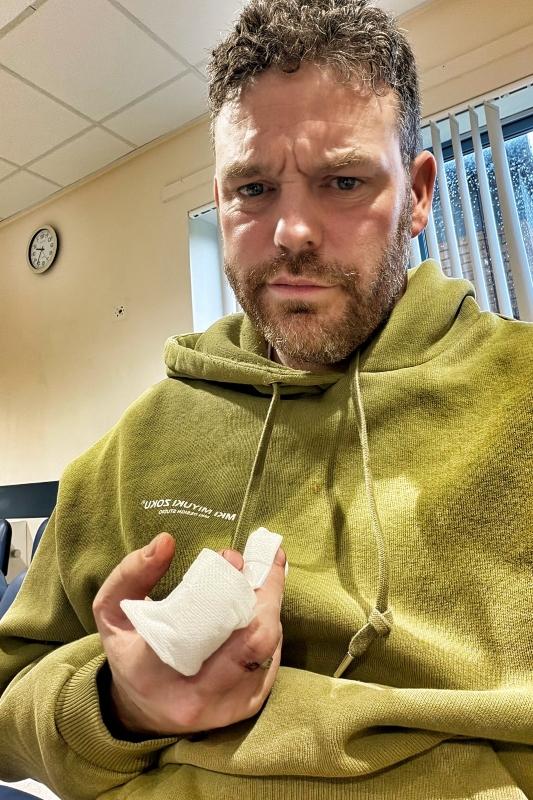 The Hoof GP holds his bandages fingers.