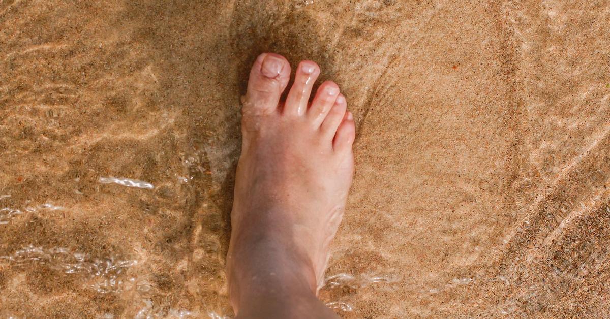 Will you get roundworms at the beach if you walk barefoot? Are