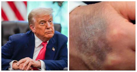 Trump's Hand Sparks Game of Thrones Greyscale Memefest